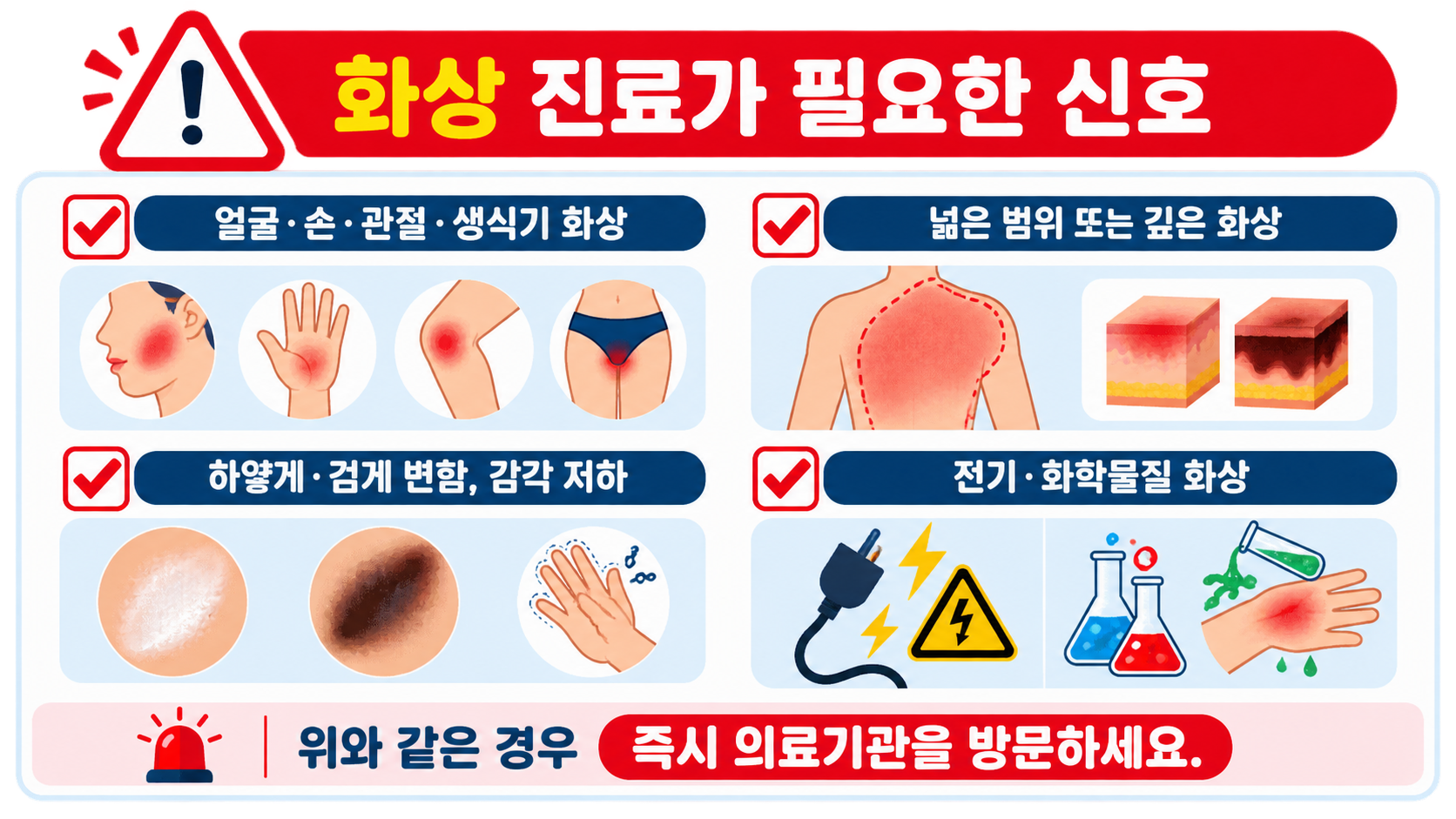 화상 진료가 필요한 부위와 깊이, 전기 화학물질 화상을 정리한 정보카드