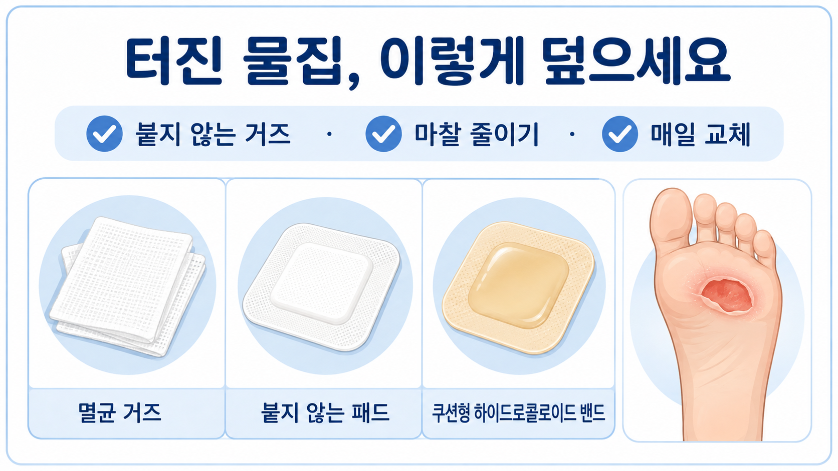 터진 발바닥 물집에 사용할 수 있는 비점착 패드와 쿠션형 밴드 선택 안내 정보카드