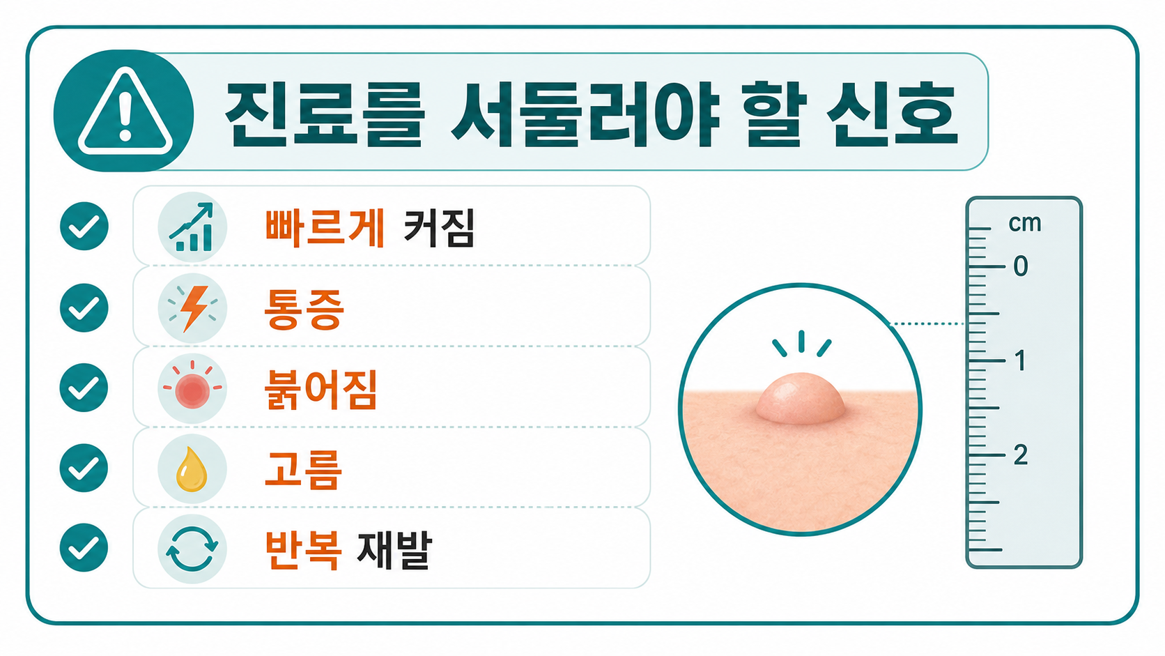 피지낭종 의심 시 빠른 진료가 필요한 성장, 통증, 붉어짐, 고름, 반복 재발 신호 정보카드