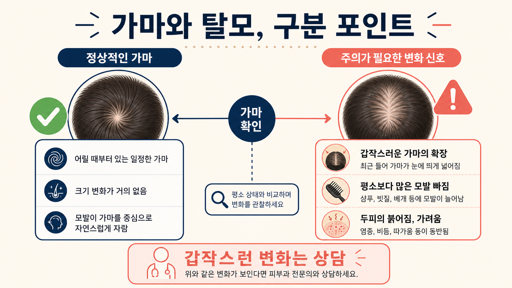 정상적인 가마와 상담이 필요한 변화 신호를 비교한 정보카드