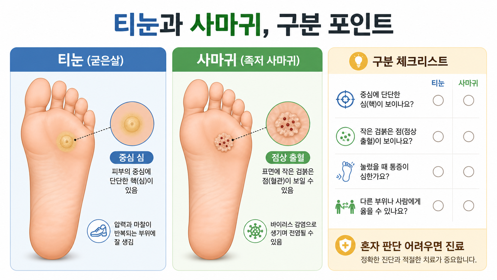 티눈과-사마귀-비교-정보-카드