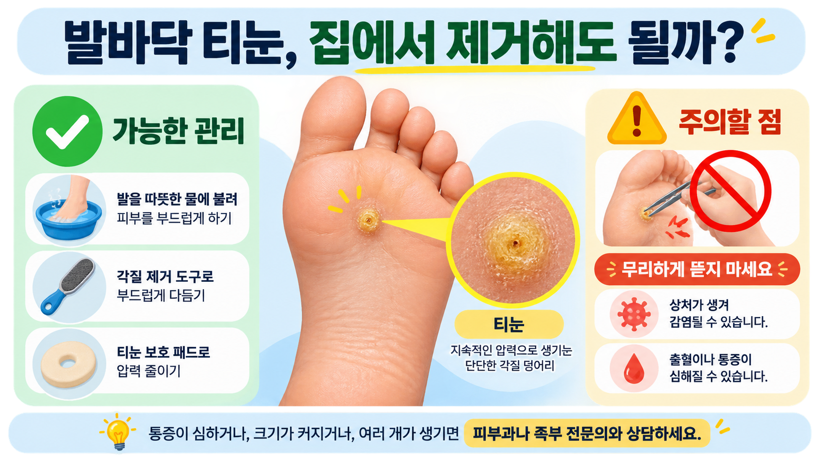 발바닥 티눈 자가 제거 주의 정보 카드